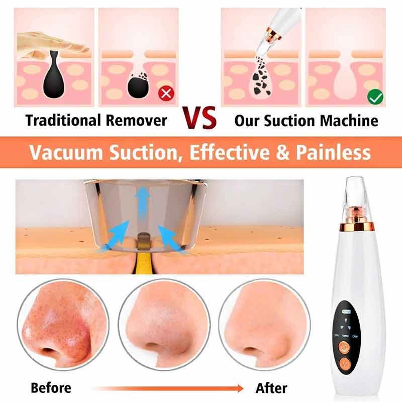 Blackhead Remover Tools Electric Derma suction Machine  USB Rechargeable Acne Pimple Pore Cleaner Vacuum tool Electric 6 in 1