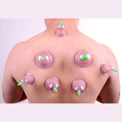 Hijama cups chinese vacuum cupping kit 12pcs