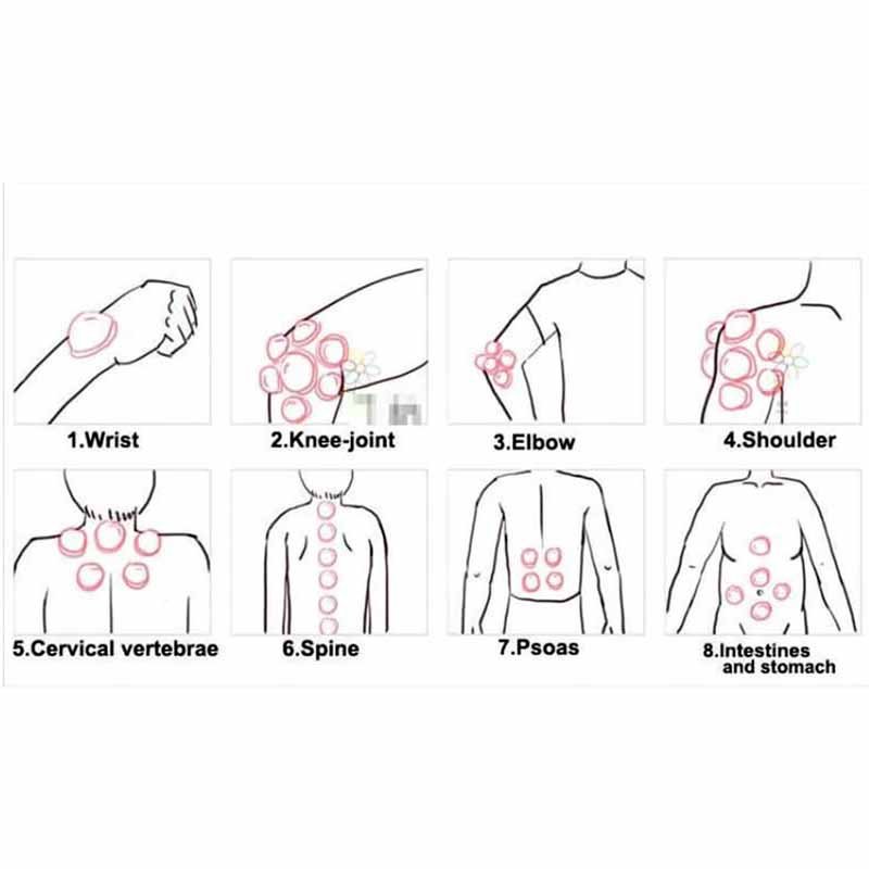 Hijama cups chinese vacuum cupping kit 12pcs